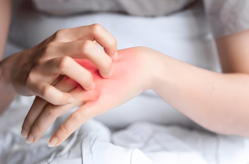 Women's Wellness Skin Diseases
